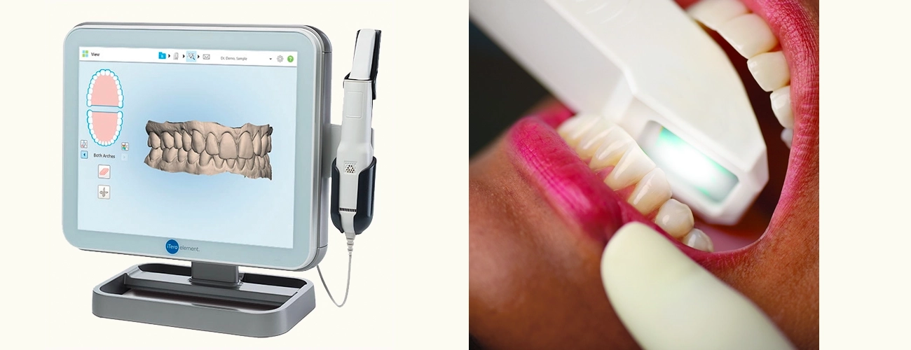 5 Factors Influencing Clear Aligner Costs